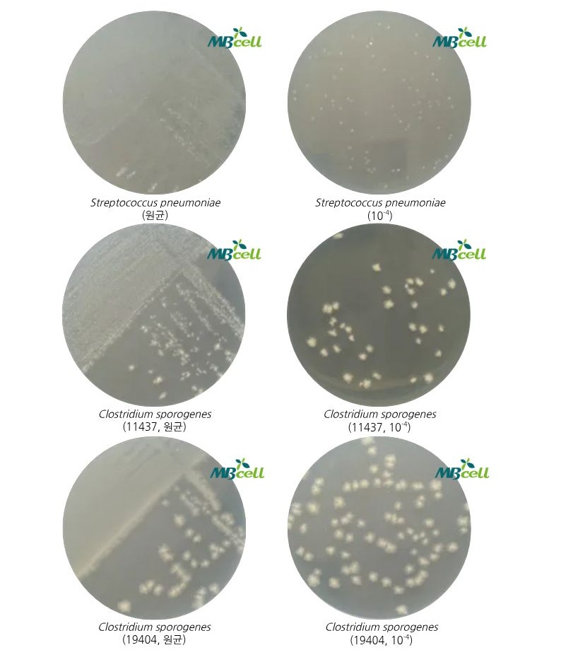 [Columbia Agar (대한약전 클로스티리디아 배지)]